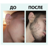 Набор #1 Новичок: 3 флакона Hairland 5% Мята + пипетка в России