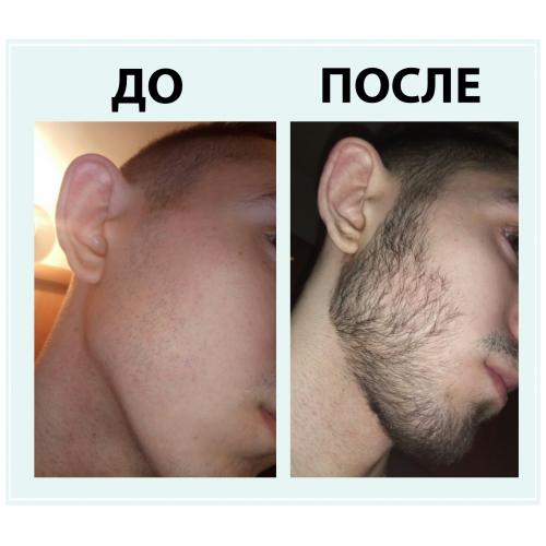 Набор #1 Новичок: 3 флакона Hairland 5% Мята + пипетка в России