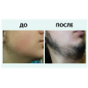 Лосьон для роста бороды и волос Hairland 5% с мятой, 60 мл в России