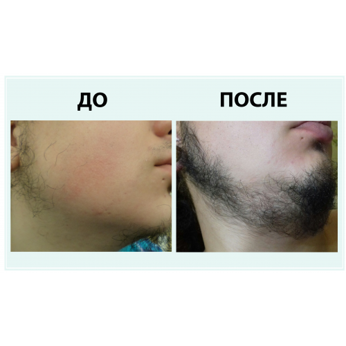 Лосьон для роста бороды и волос Hairland 5% с мятой, 60 мл в России