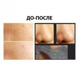 Очищающие полоски от черных точек с углём Luke Charcoal Nose Cleansing Strips 10 шт